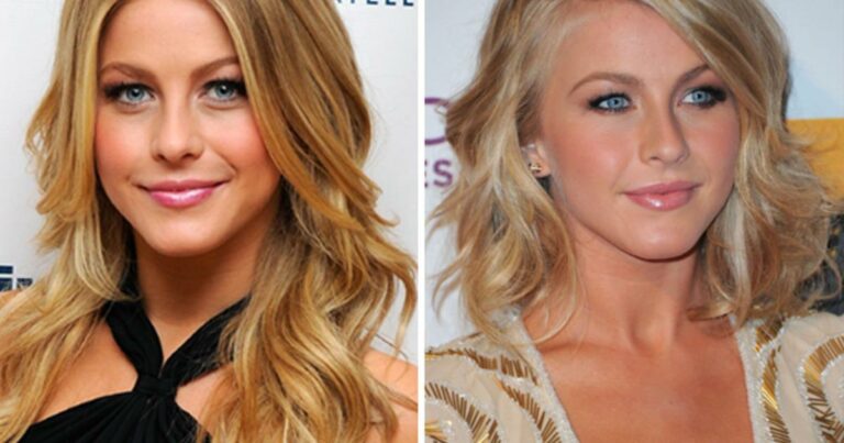 Julianne Hough’s Beauty Evolution: Debunking Plastic Surgery Speculations