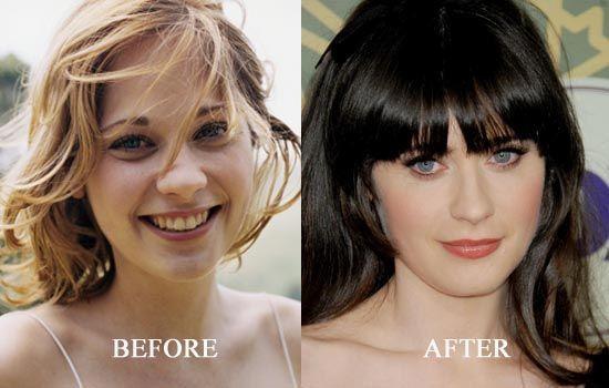 Zooey Deschanel Plastic Surgery: A Melody of Transformation and Speculation